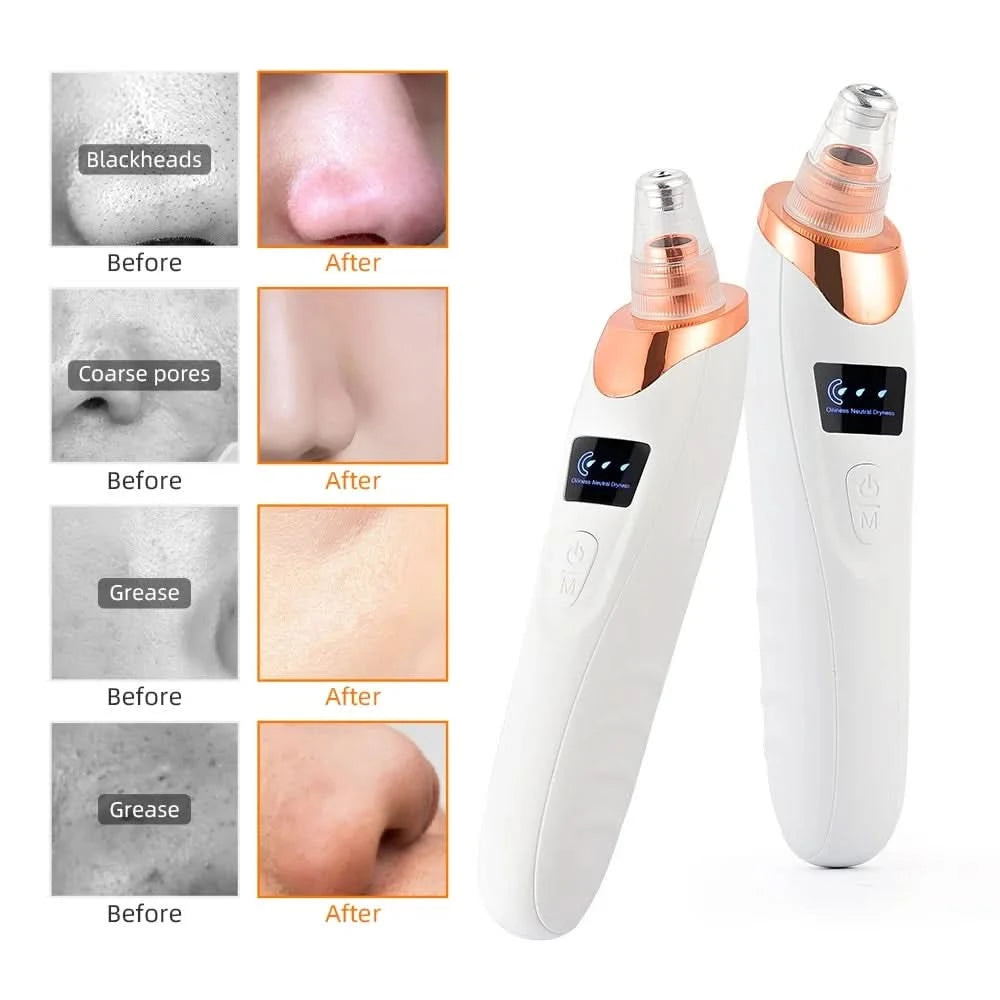 Nose Blackhead Remover Face Cleansing Beauty Machine Facial Suction Cleaner Pimple Dead Skin Remover Extractor Skin Care Tools - M & M Global