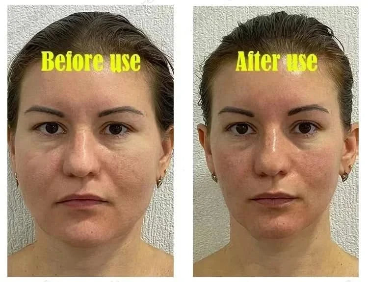 Effective V-Shape Face Slimming Lifting Facial Cream Lift Up V Double Chin Cheek Slimming Firming Anti Wrinkle Beauty Skin Care - M & M Global