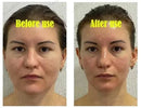 Effective V-Shape Face Slimming Lifting Facial Cream Lift Up V Double Chin Cheek Slimming Firming Anti Wrinkle Beauty Skin Care - M & M Global