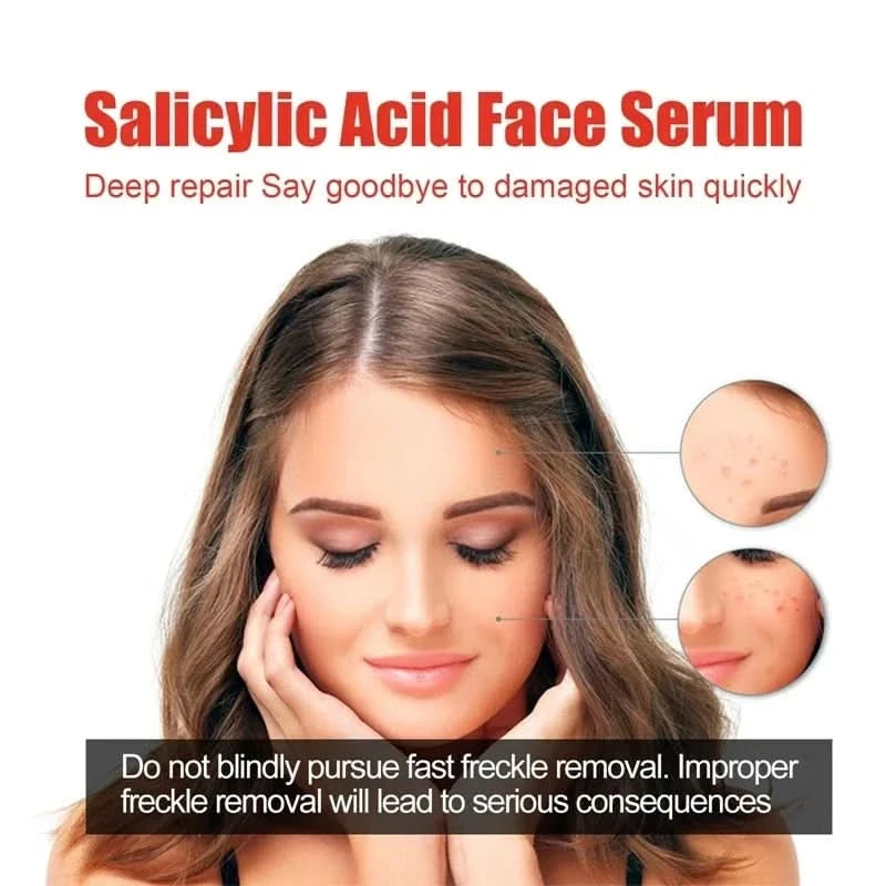 Niacinamide Facial Serum Salicylic Acid Moisturizing Skin Care Products 2024 - M & M Global
