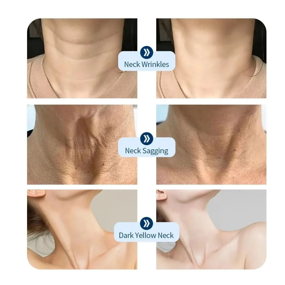 Neck LED Lift Mask Photon Anti-Wrinkle Skin Tightening Neck Beauty Device Skin Brighten Rejuvenation Neck Wrinkle Remover - M & M Global