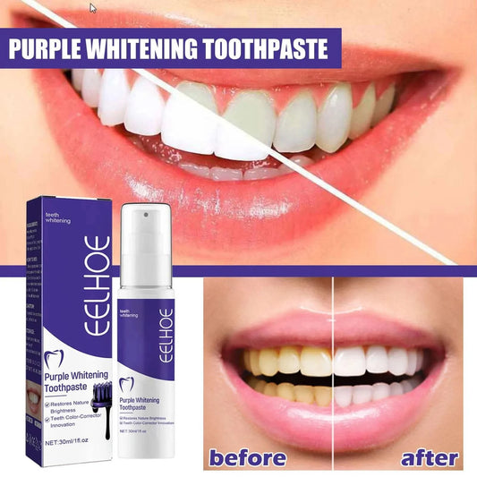 Advanced Teeth Whitening Toothpaste For Oral care, Cavity Treatment And Teeth Whitening in Weeks. For Adults’ Dental Health - M & M Global