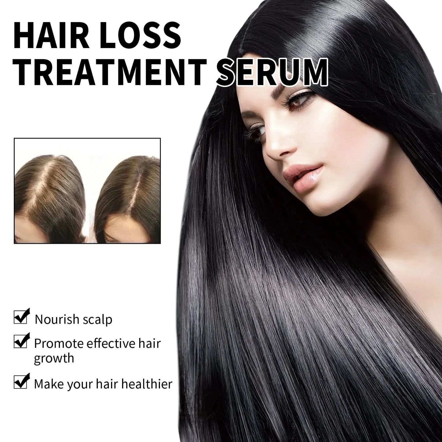 Hair Loss Treatment Shampoo Anti-itch Anti Dandruff Oil Control Hair Growth Serum Oil Scalp Root Thicker Fast Regrowth Essence - M & M Global