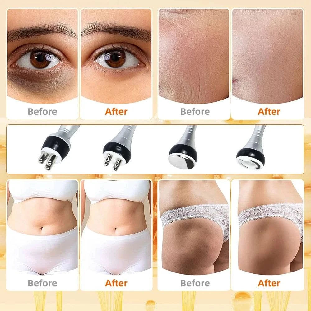 40K 4IN1 Cavitation Body Slimming Machine Beauty Massager Skin Tighten Face Lifting Vacuum Suction With Gel （Fast Shipping） - M & M Global