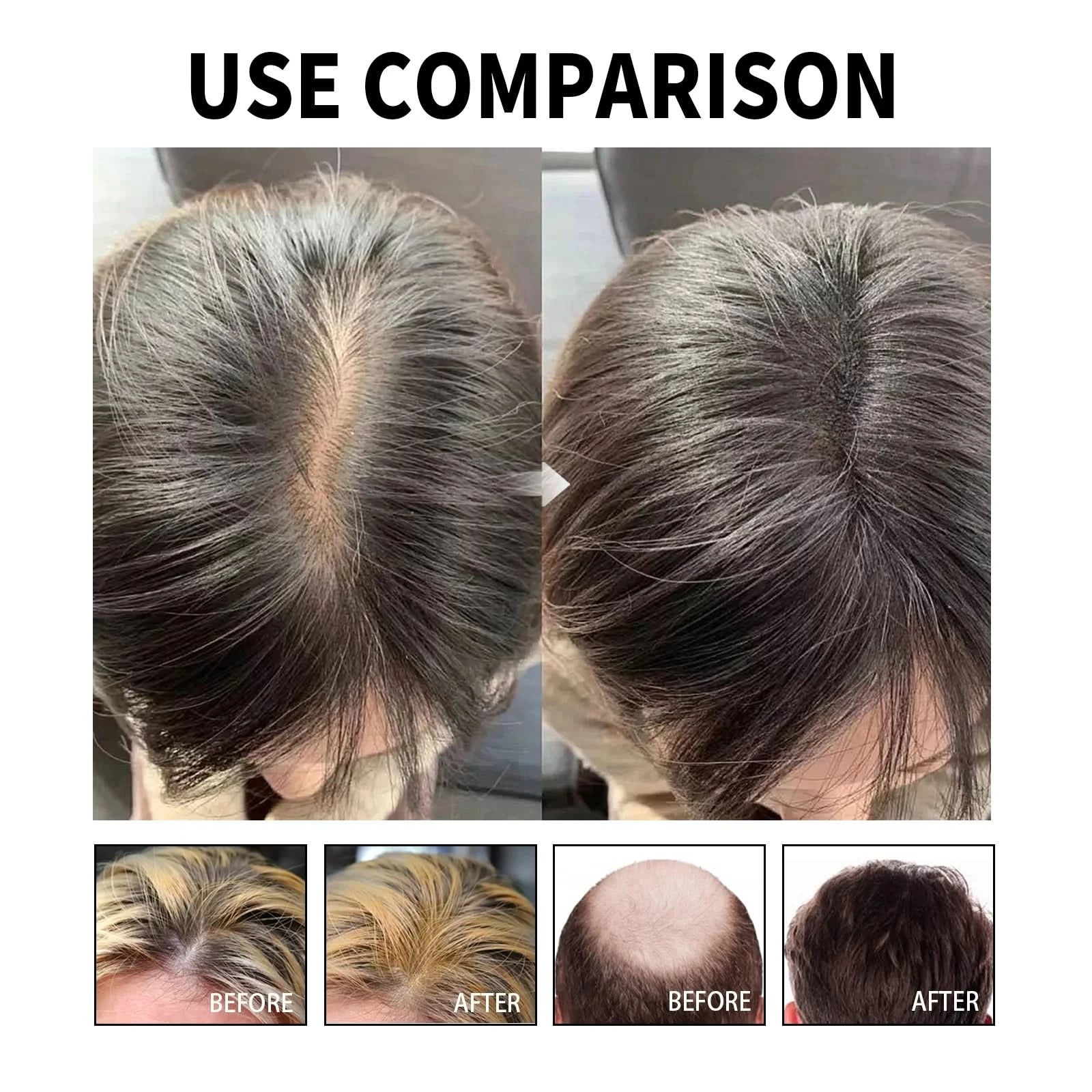 Hair Loss Treatment Shampoo Anti-itch Anti Dandruff Oil Control Hair Growth Serum Oil Scalp Root Thicker Fast Regrowth Essence - M & M Global