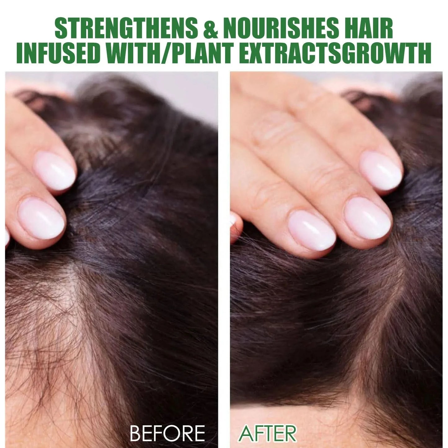 Rosemary Hair Care Set Contains Rosemary Hair Roller Hair Spray Essential Oil Nourish Hair Soft Fluffy Strong Moisturizing Root - M & M Global