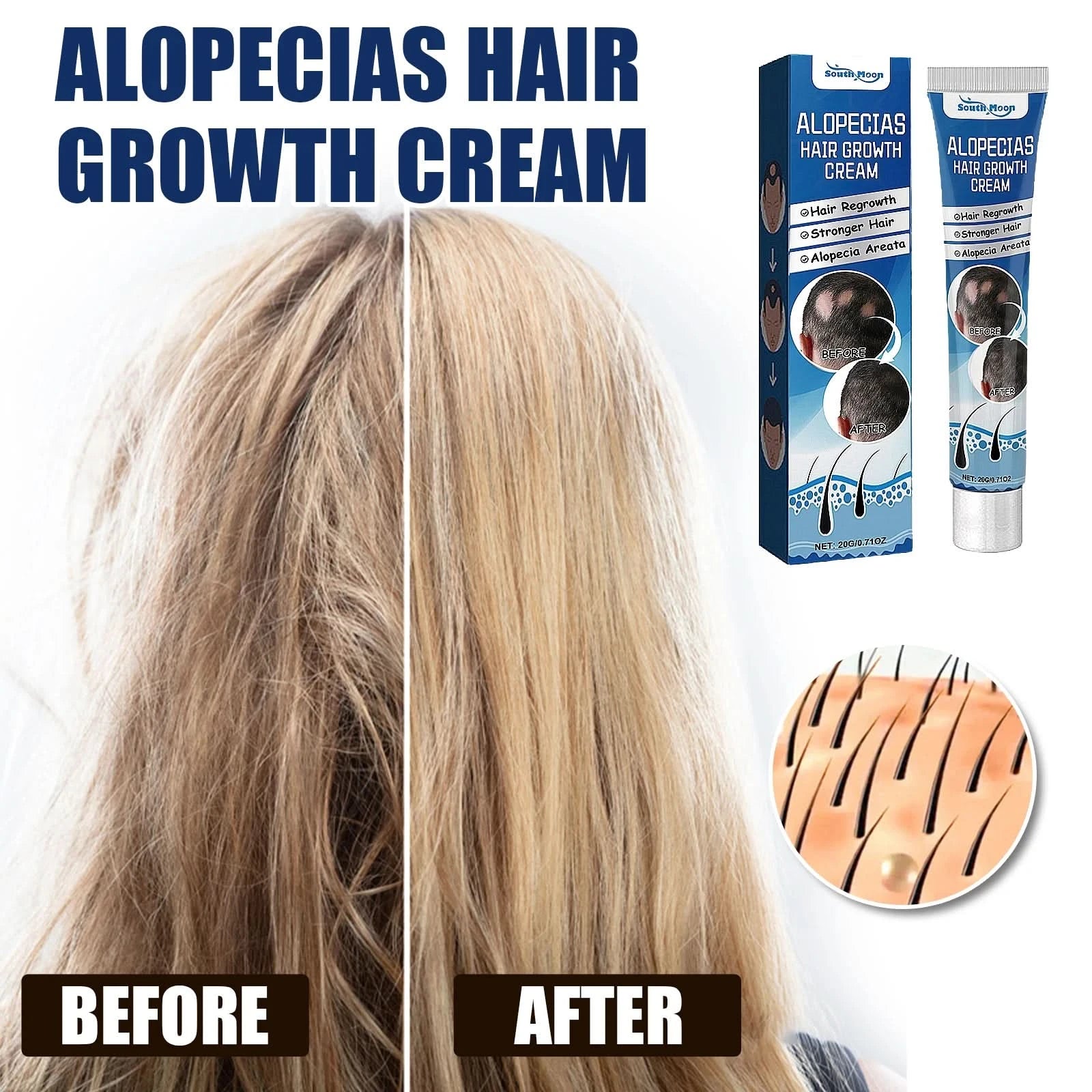South Moon Sophora flavescens baldness cream head skin care cream cross-border foreign trade hair care Protecting - M & M Global