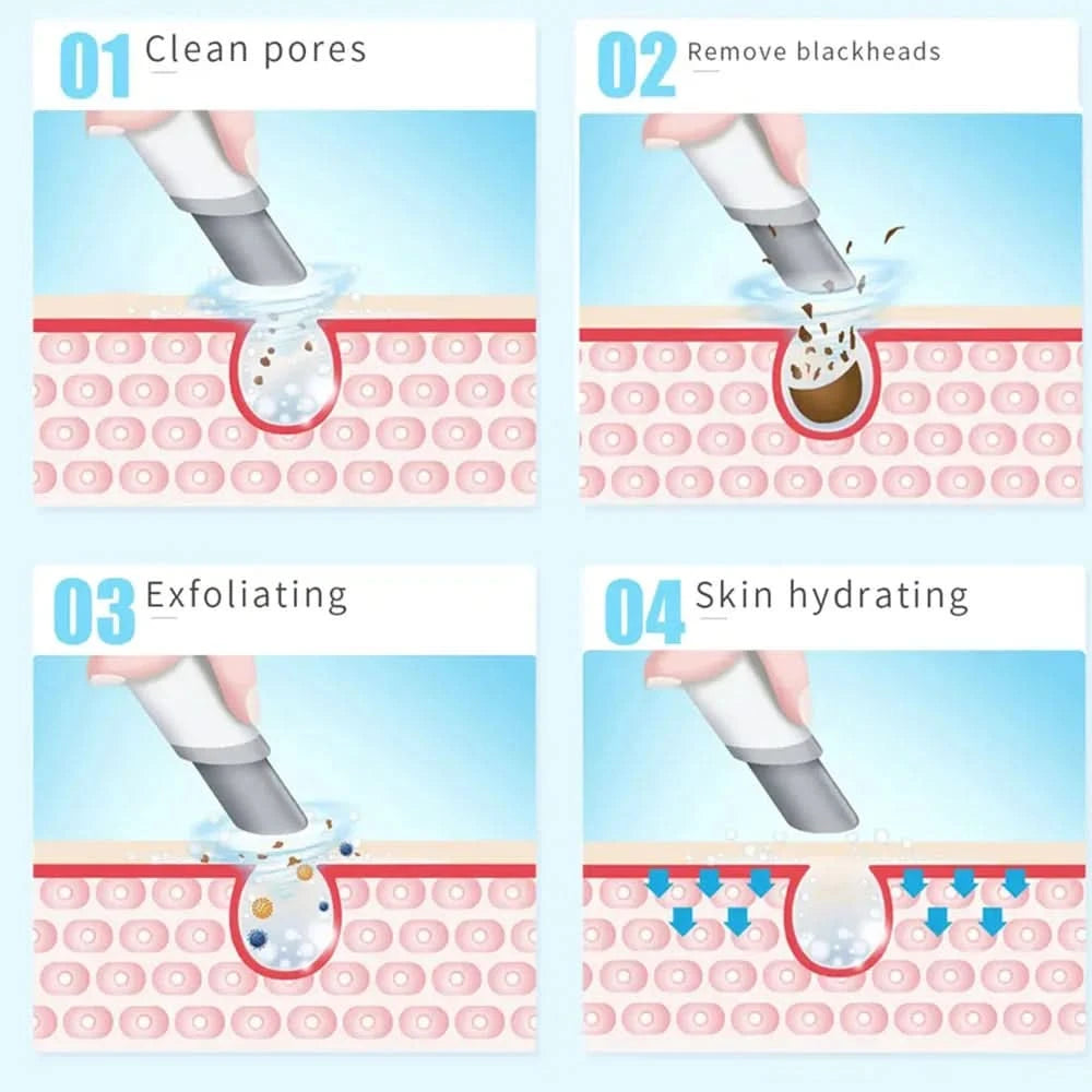 Face Beauty Device 2 In1 Pore Vacuum Cleaner Electric Micro Small Bubble Facial Cleaning Machine Skin Rejuvenation Sprayer Spa - M & M Global