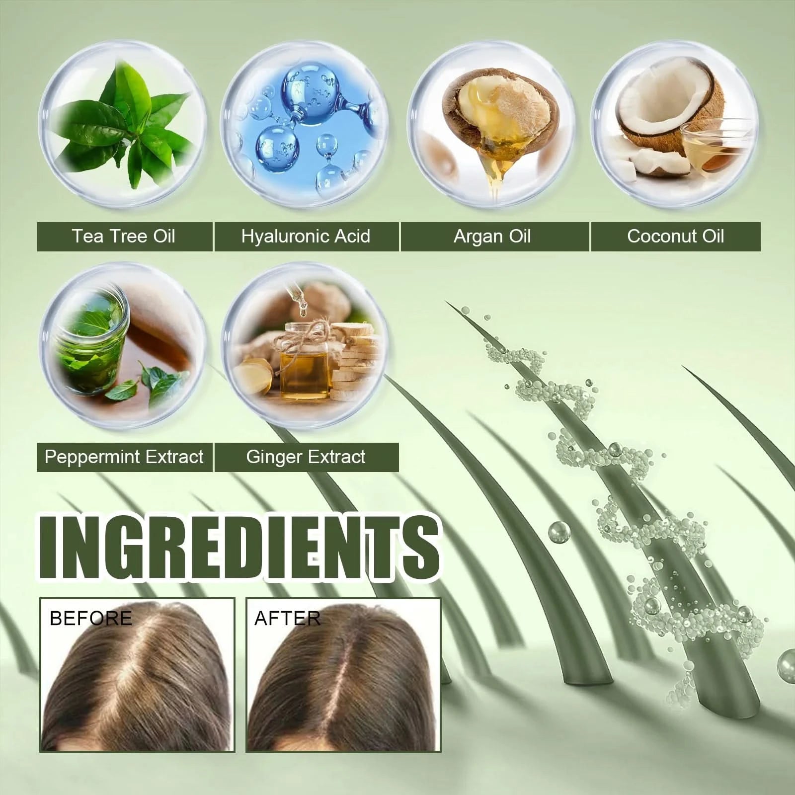 Fast Hair Growth Oil Africa Crazy Traction Alopecia Serum Anti Hair Break Thicken Hair Loss Treatment Spray Beauty Health - M & M Global