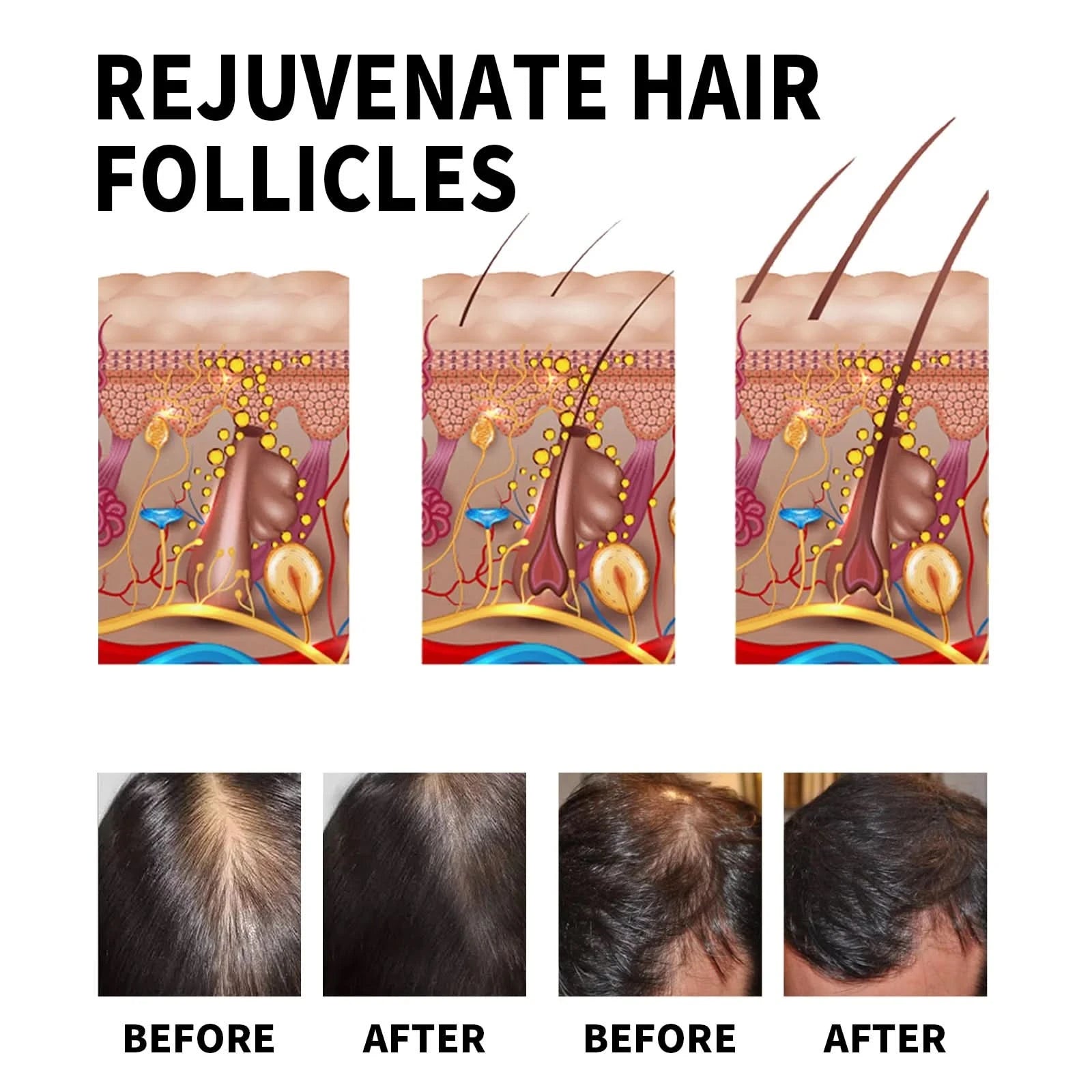 Hair Loss Treatment Shampoo Anti-itch Anti Dandruff Oil Control Hair Growth Serum Oil Scalp Root Thicker Fast Regrowth Essence - M & M Global