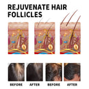 Hair Loss Treatment Shampoo Anti-itch Anti Dandruff Oil Control Hair Growth Serum Oil Scalp Root Thicker Fast Regrowth Essence - M & M Global