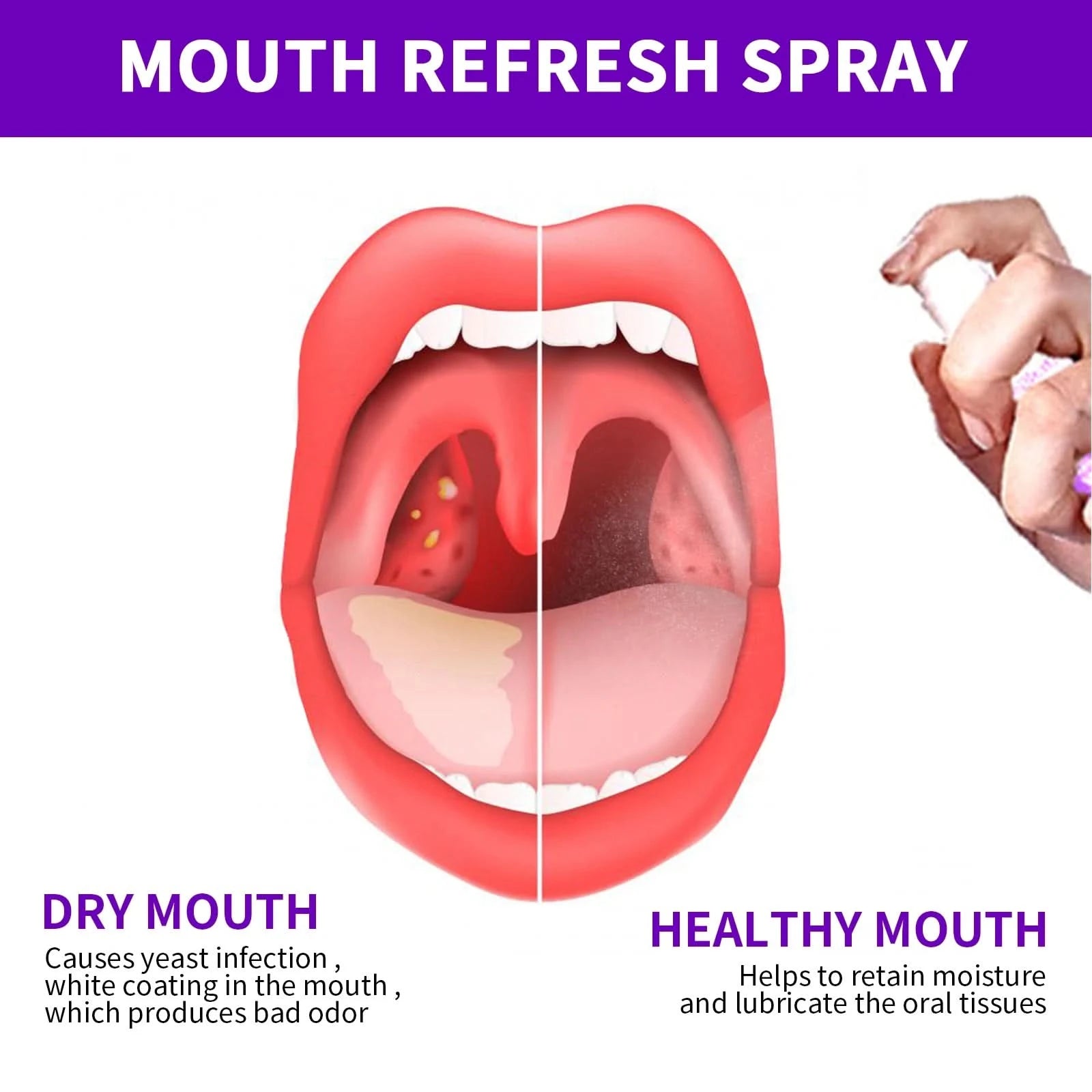 Fresh Oral Spray Clean Oral Prevent Bad Breath Leave Fragrance For A Long Time Portable Oral Spray Suitable For Both Men & Women - M & M Global