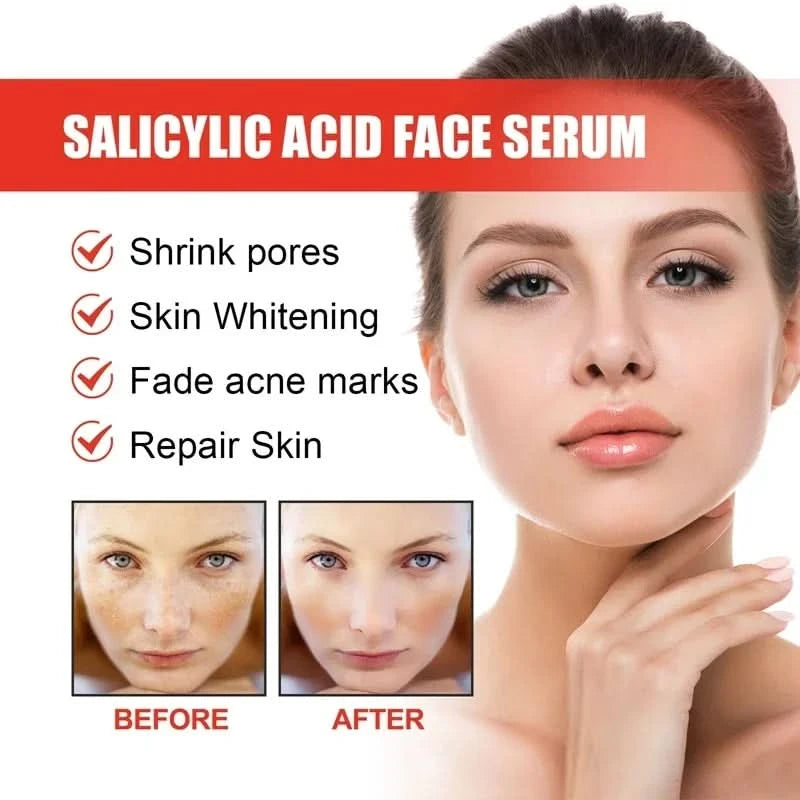 Niacinamide Facial Serum Salicylic Acid Moisturizing Skin Care Products 2024 - M & M Global