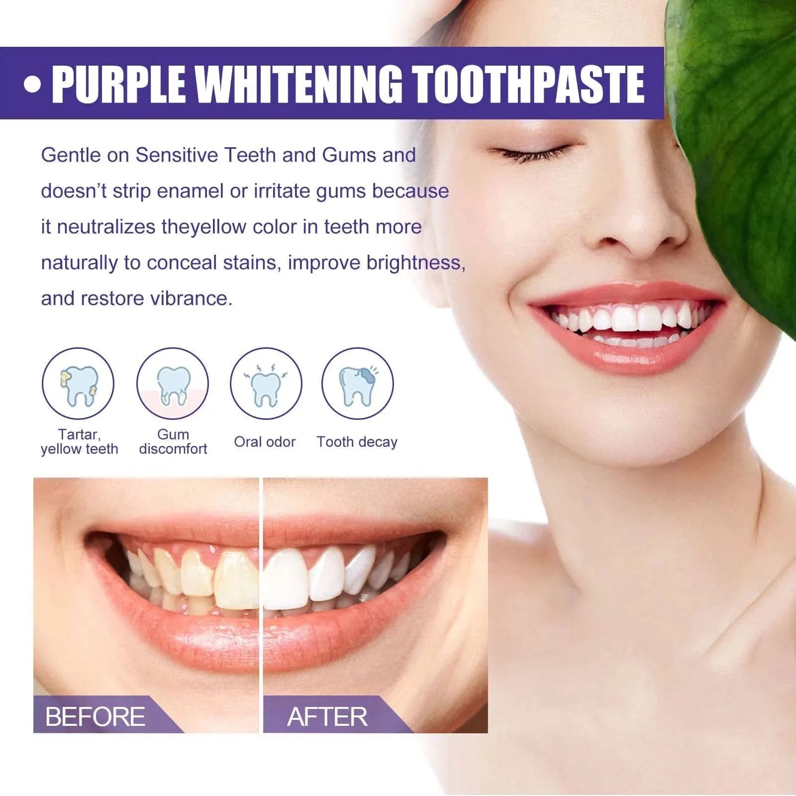 Advanced Teeth Whitening Toothpaste For Oral care, Cavity Treatment And Teeth Whitening in Weeks. For Adults’ Dental Health - M & M Global