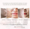Electric Facial Cleansing Brush Deep Pore Cleaning Sonic Vibration Waterproof Acne Blackhead Remover Pore Cleaner Silicone - M & M Global