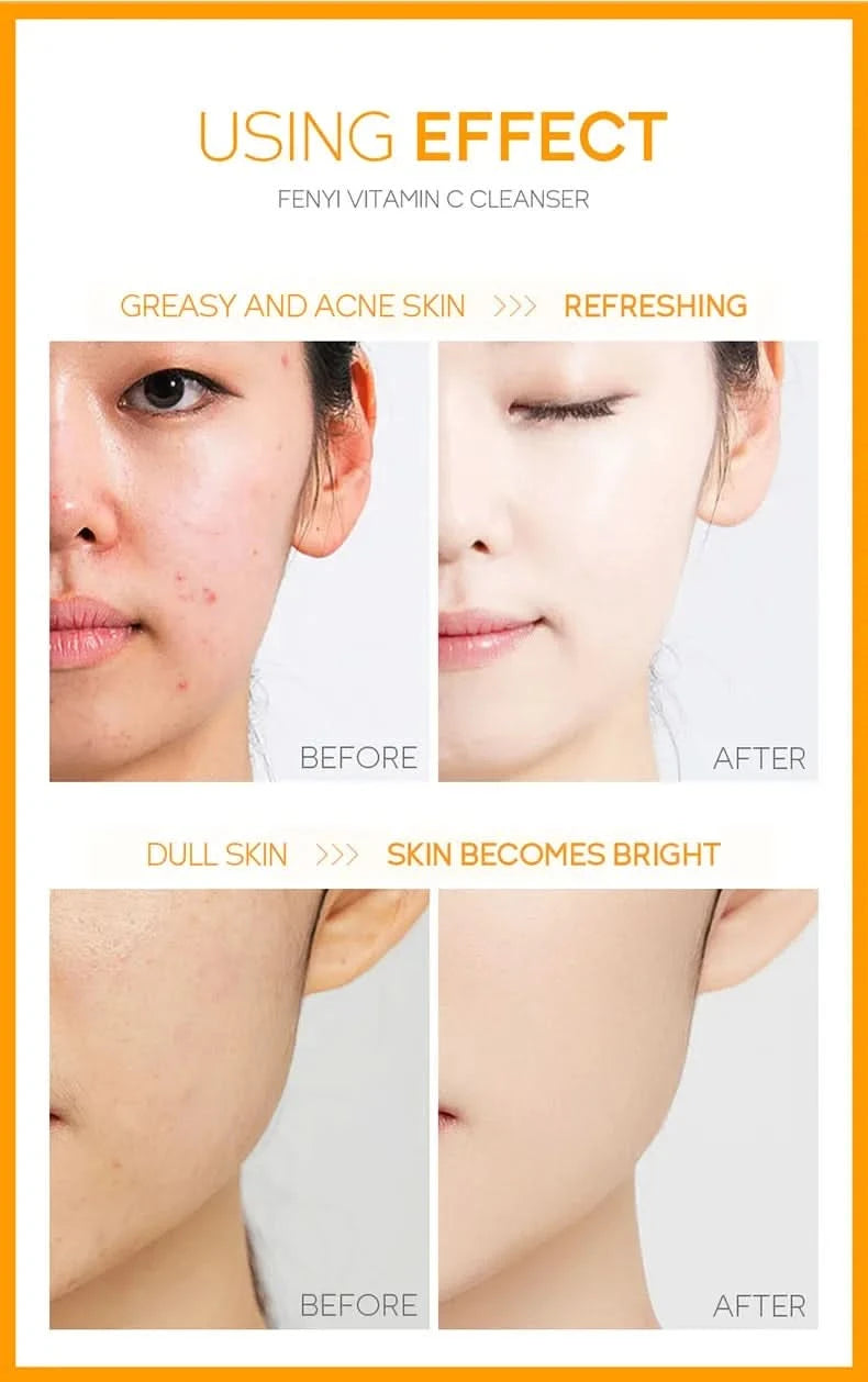 Vitamin C Facial Cleanser Skin Cleansing Moisturizing  Blackhead Remove Skincare Face Wash Foam Face Cleanser 50g - M & M Global