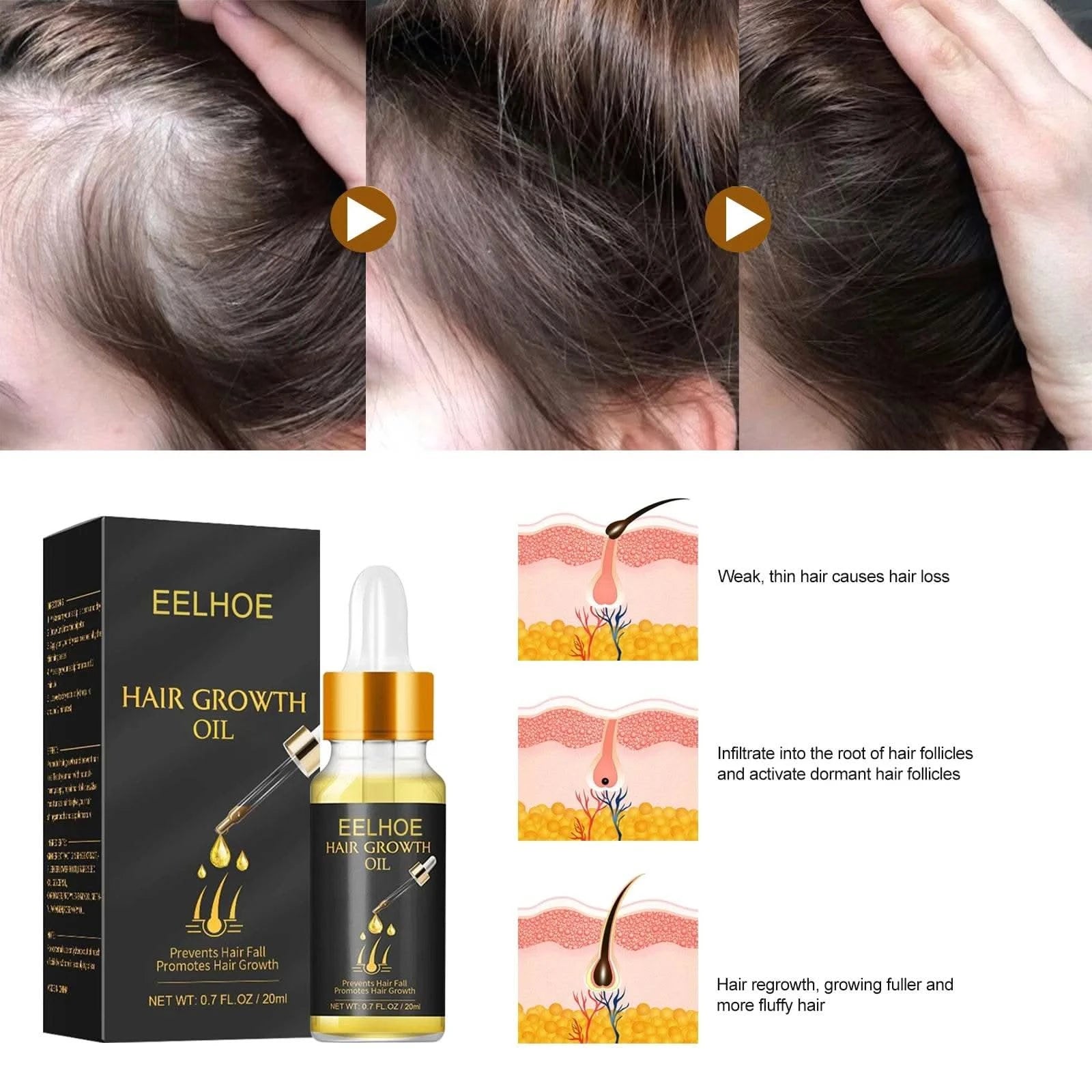 Dense Hair Essence Strong Firm Hair Care Soft & Nourishing Thick Hair Nutrition Liquid Strengthening Hair Anti Loss Hair Serum - M & M Global