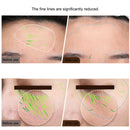 EMS Facial Body Radio Frequency Machine Skin Tightening Face Lifting RF Beauty Device Professional Home RF Skin Care Anti Aging - M & M Global