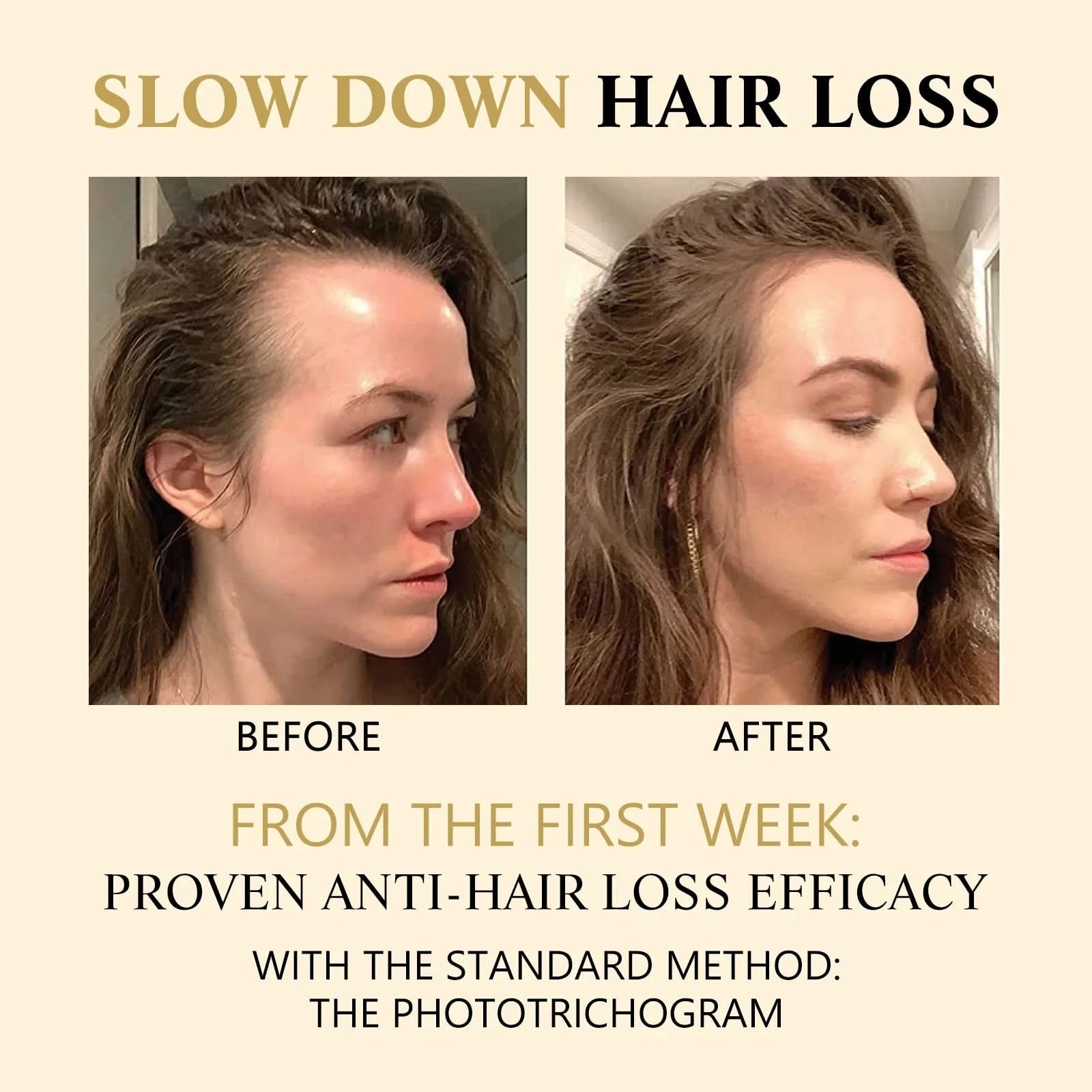 Hair Growth Essential Loss Regrowth Treatment Strengthens Hair Nourishes Scalp Light Weight Non Greasy Improve Scalp Circulation - M & M Global