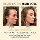 Hair Growth Essential Loss Regrowth Treatment Strengthens Hair Nourishes Scalp Light Weight Non Greasy Improve Scalp Circulation - M & M Global