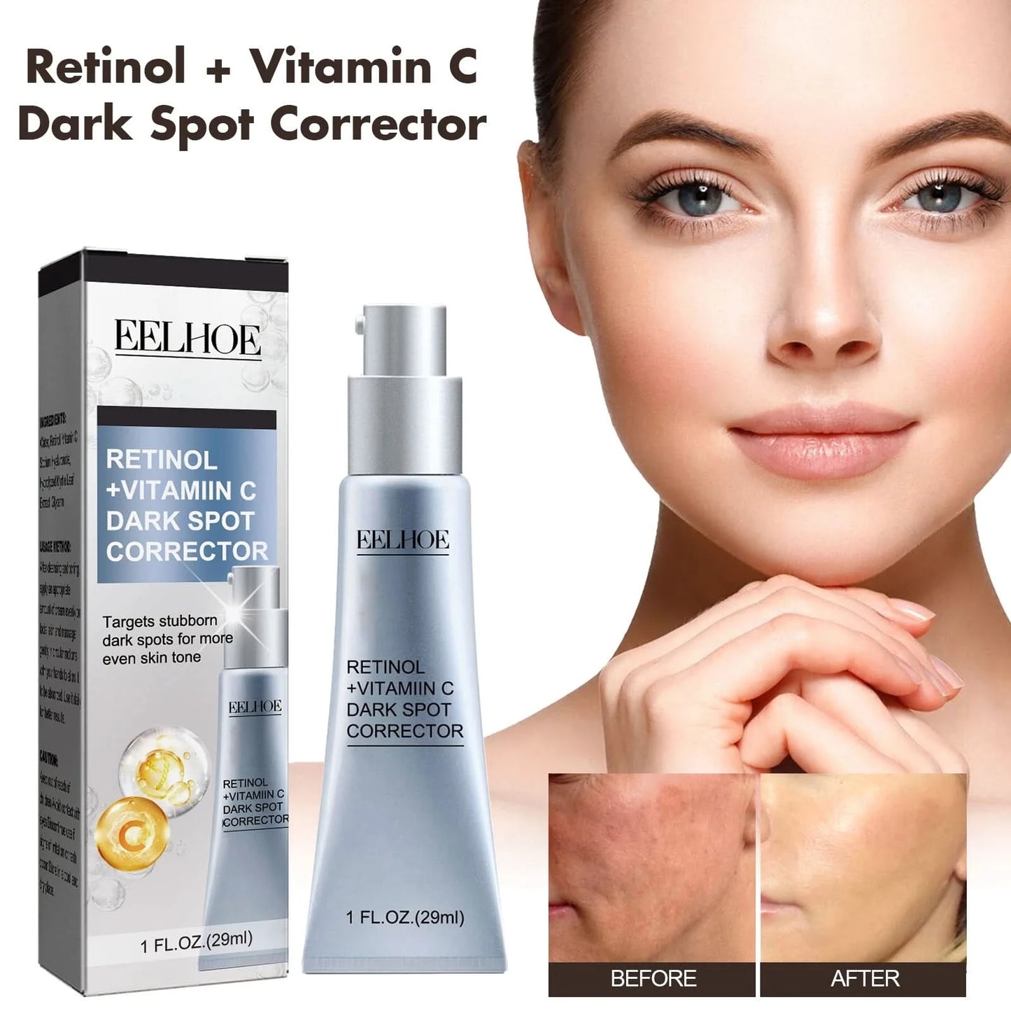 Women Fade Melasma Cream Lightening Dull Brightening Emulsion Remove Dark Stains Brighten Cream Dark Skin Moisturize Products - M & M Global