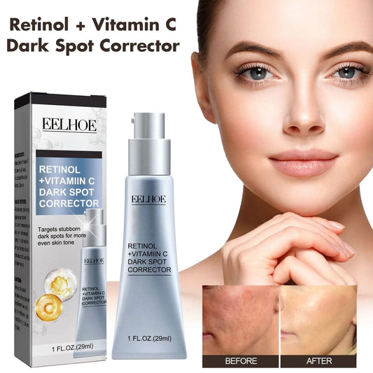 Women Fade Melasma Cream Lightening Dull Brightening Emulsion Remove Dark Stains Brighten Cream Dark Skin Moisturize Products - M & M Global