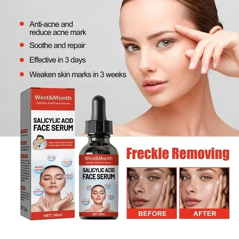 Niacinamide Facial Serum Salicylic Acid Moisturizing Skin Care Products 2024 - M & M Global