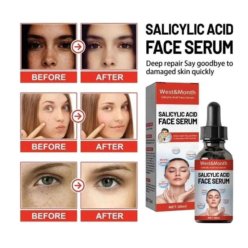Niacinamide Facial Serum Salicylic Acid Moisturizing Skin Care Products 2024 - M & M Global