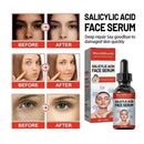 Niacinamide Facial Serum Salicylic Acid Moisturizing Skin Care Products 2024 - M & M Global