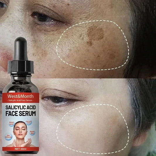 Niacinamide Facial Serum Salicylic Acid Moisturizing Skin Care Products 2024 - M & M Global