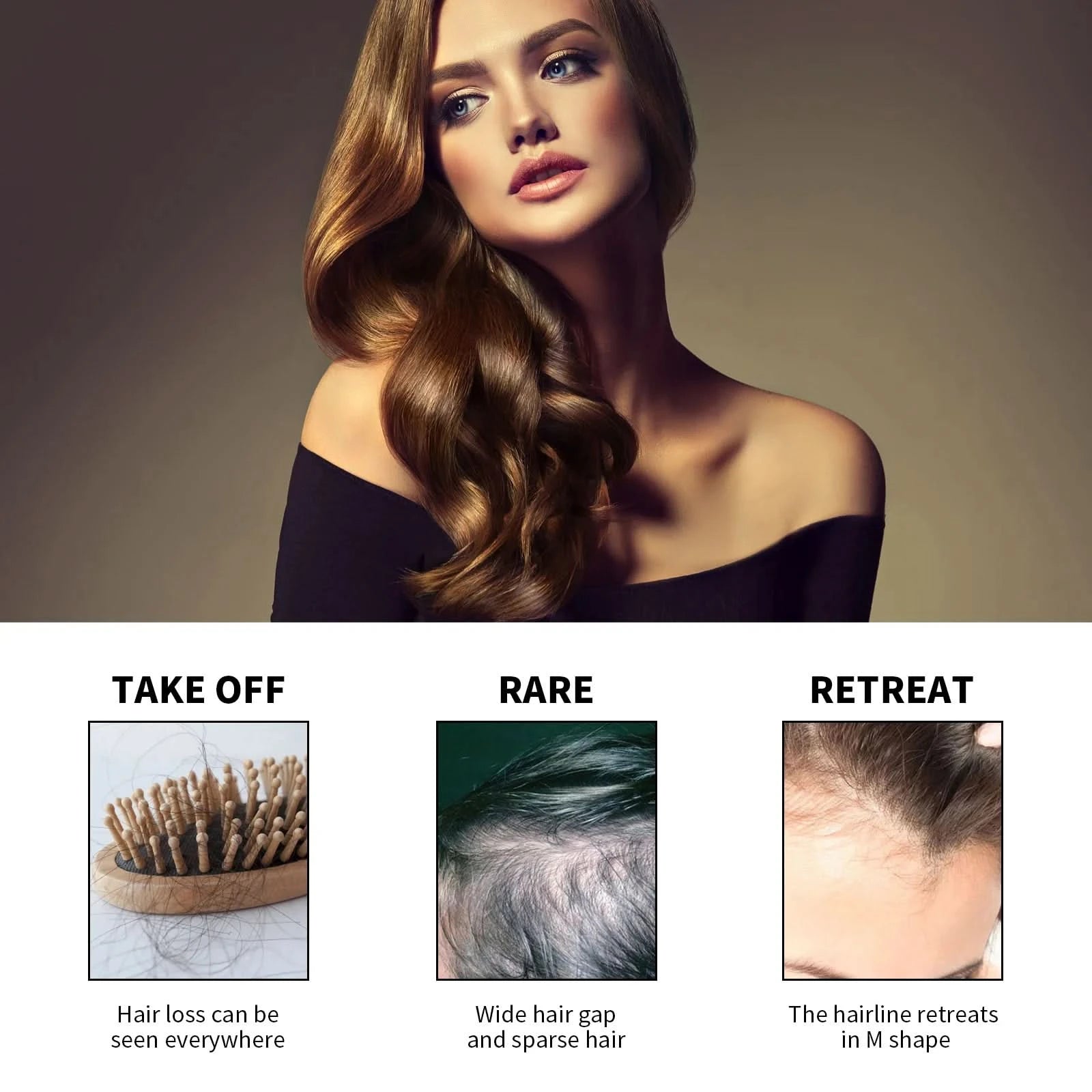 Hair Loss Treatment Shampoo Anti-itch Anti Dandruff Oil Control Hair Growth Serum Oil Scalp Root Thicker Fast Regrowth Essence - M & M Global