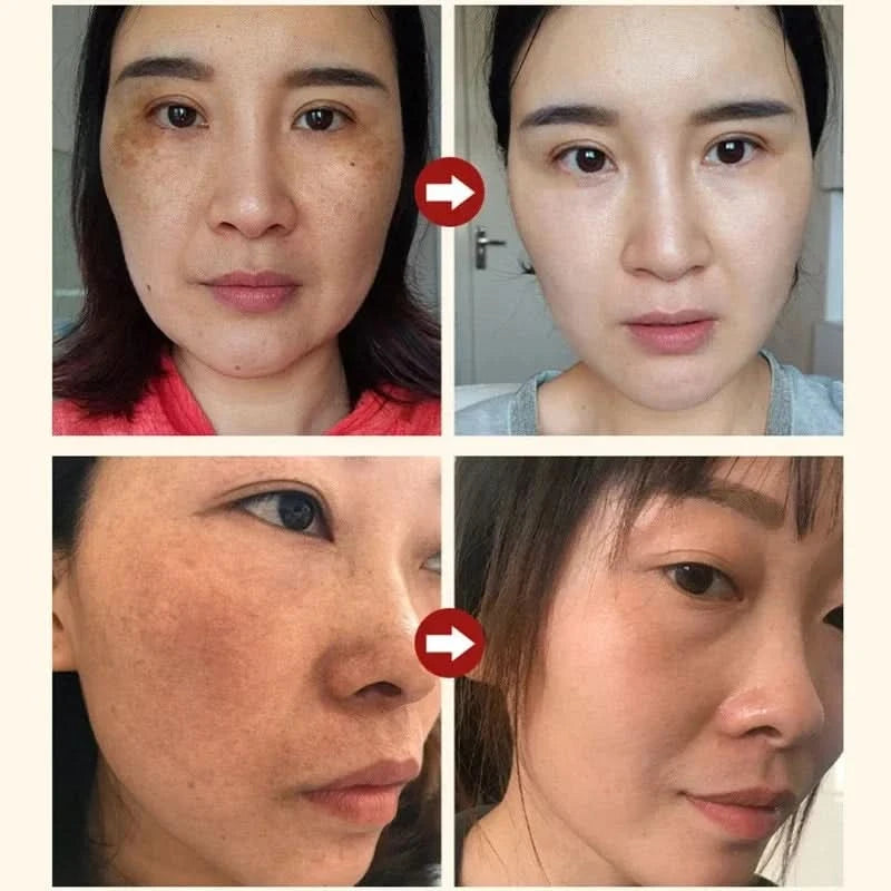 Niacinamide Facial Serum Salicylic Acid Moisturizing Skin Care Products 2024 - M & M Global