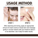 Women Fade Melasma Cream Lightening Dull Brightening Emulsion Remove Dark Stains Brighten Cream Dark Skin Moisturize Products - M & M Global