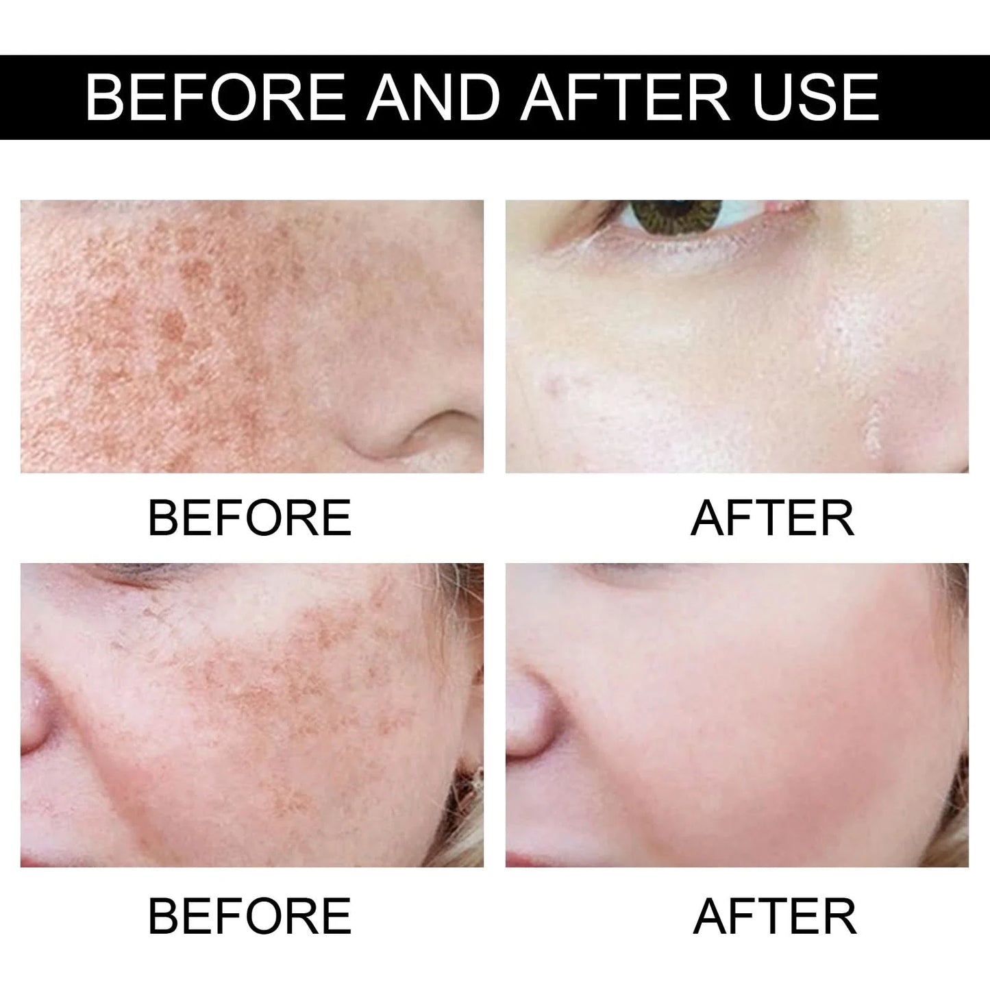 Women Fade Melasma Cream Lightening Dull Brightening Emulsion Remove Dark Stains Brighten Cream Dark Skin Moisturize Products - M & M Global