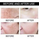 Women Fade Melasma Cream Lightening Dull Brightening Emulsion Remove Dark Stains Brighten Cream Dark Skin Moisturize Products - M & M Global
