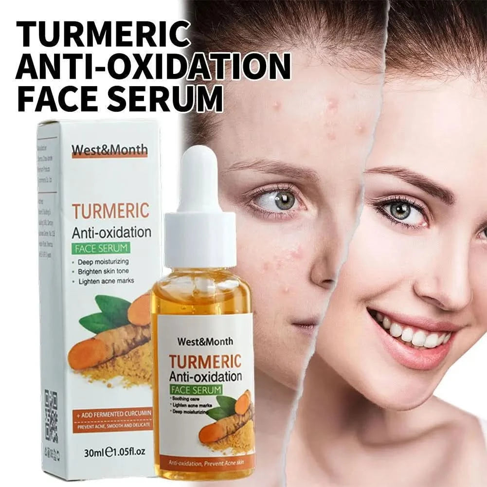Turmeric Face Whitening Serum Turmeric Anti-oxidation Serum Turmeric Dark Spot Corrector Serum Facial Brighten Turmeric Oil Soap - M & M Global