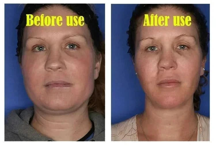 Effective V-Shape Face Slimming Lifting Facial Cream Lift Up V Double Chin Cheek Slimming Firming Anti Wrinkle Beauty Skin Care - M & M Global