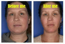Effective V-Shape Face Slimming Lifting Facial Cream Lift Up V Double Chin Cheek Slimming Firming Anti Wrinkle Beauty Skin Care - M & M Global