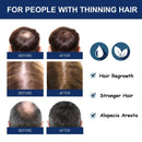 South Moon Sophora flavescens baldness cream head skin care cream cross-border foreign trade hair care Protecting - M & M Global