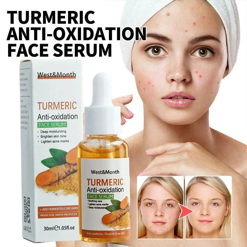Turmeric Face Whitening Serum Turmeric Anti-oxidation Serum Turmeric Dark Spot Corrector Serum Facial Brighten Turmeric Oil Soap - M & M Global