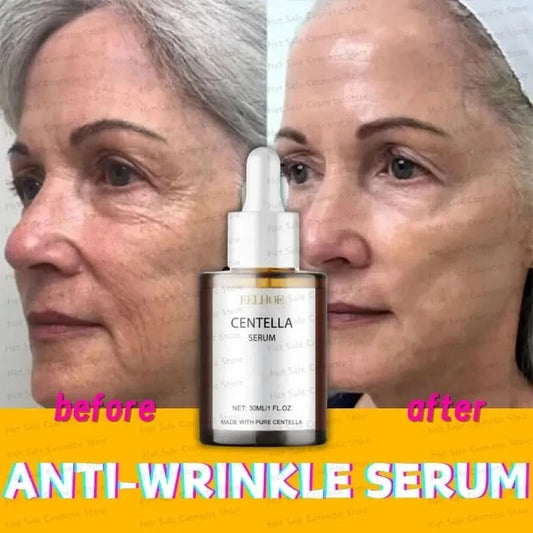 Korean Centella Asiatica Face Serum Nourish Dry Skin Smoothing Rejuvenation Skin Brightening Whitening Cream Facial Moisturizer - M & M Global