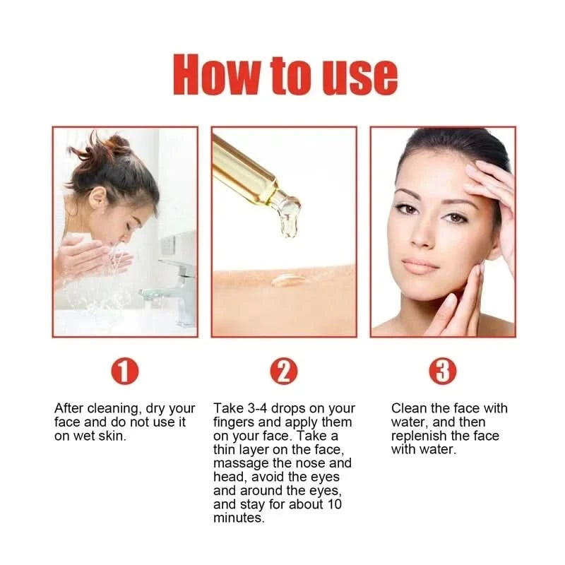 Niacinamide Facial Serum Salicylic Acid Moisturizing Skin Care Products 2024 - M & M Global