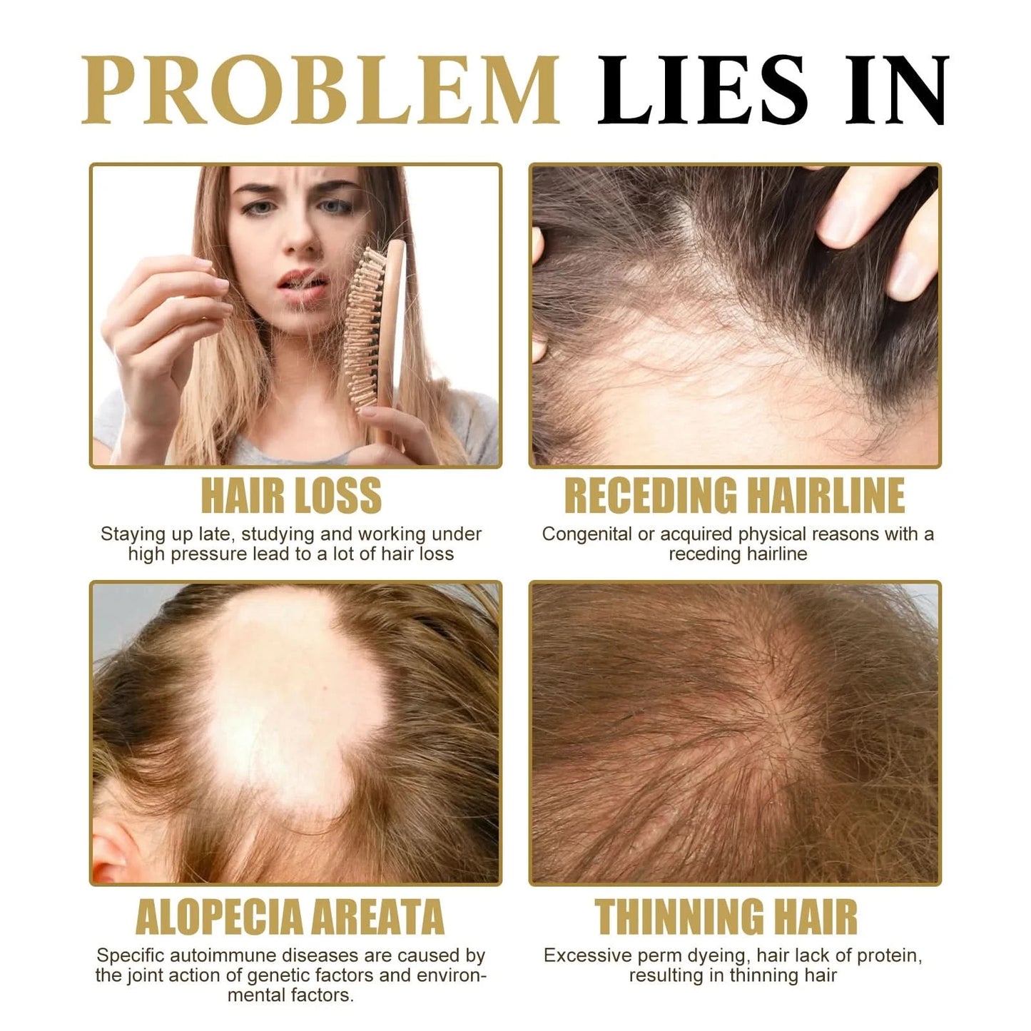Hair Growth Essential Loss Regrowth Treatment Strengthens Hair Nourishes Scalp Light Weight Non Greasy Improve Scalp Circulation - M & M Global