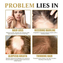 Hair Growth Essential Loss Regrowth Treatment Strengthens Hair Nourishes Scalp Light Weight Non Greasy Improve Scalp Circulation - M & M Global