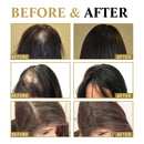 Hair Growth Essential Loss Regrowth Treatment Strengthens Hair Nourishes Scalp Light Weight Non Greasy Improve Scalp Circulation - M & M Global