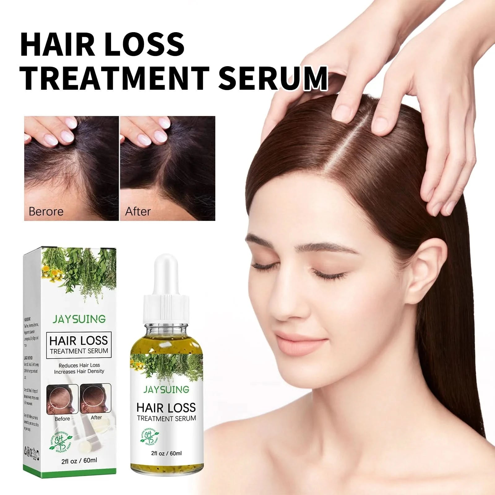 Hair Loss Treatment Shampoo Anti-itch Anti Dandruff Oil Control Hair Growth Serum Oil Scalp Root Thicker Fast Regrowth Essence - M & M Global