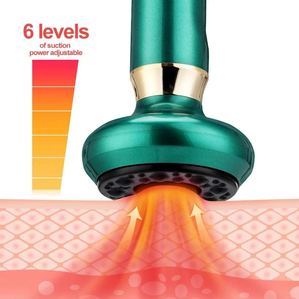 Chinese Electric Suction Vacuum Cupping Anti Cellulite Beauty Massager Glass Jars Anti Cellulite Cupping Vacuum Slimming Guasha - M & M Global