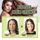 Fast Hair Growth Oil Africa Crazy Traction Alopecia Serum Anti Hair Break Thicken Hair Loss Treatment Spray Beauty Health - M & M Global