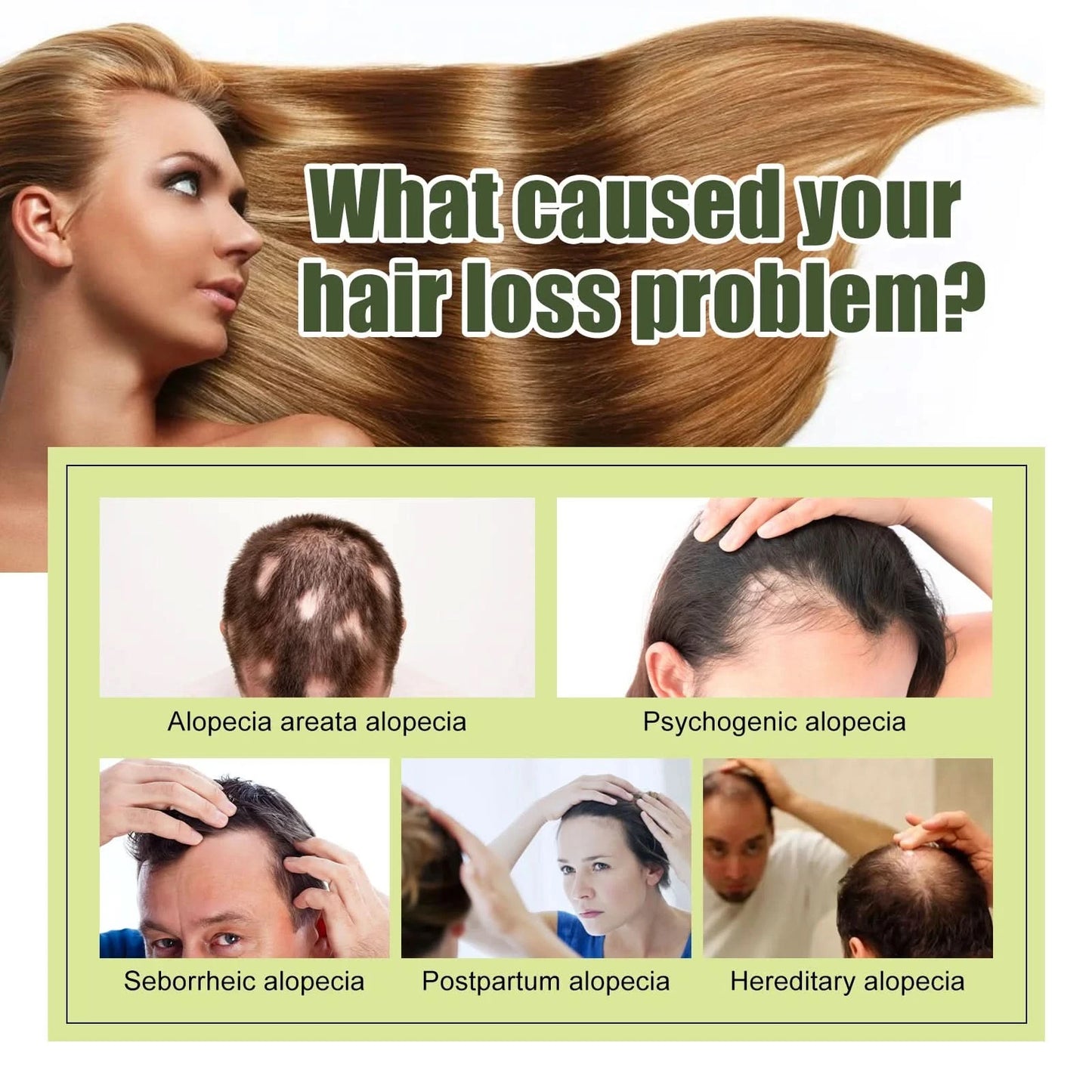 Fast Hair Growth Oil Africa Crazy Traction Alopecia Serum Anti Hair Break Thicken Hair Loss Treatment Spray Beauty Health - M & M Global