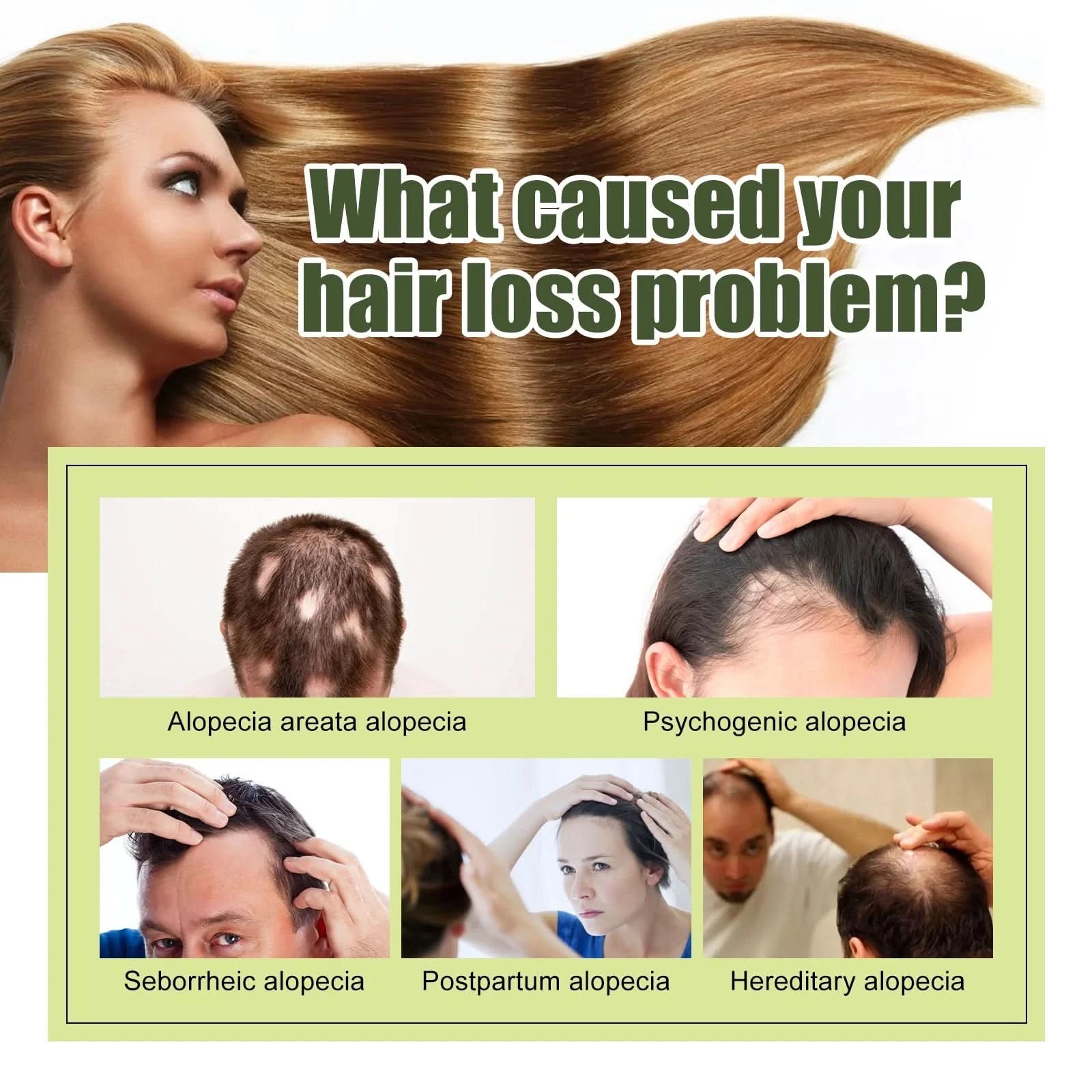 Fast Hair Growth Oil Africa Crazy Traction Alopecia Serum Anti Hair Break Thicken Hair Loss Treatment Spray Beauty Health - M & M Global